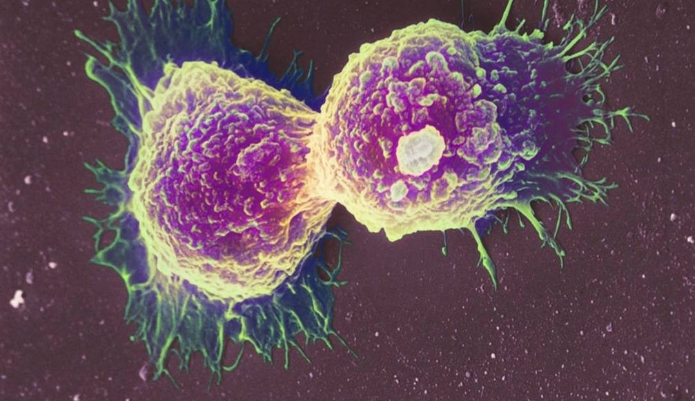 Descoberto anticorpo capaz de retardar o câncer