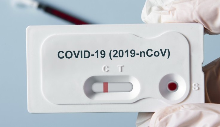 Aumenta o número de testes rápidos positivos para Covid-19