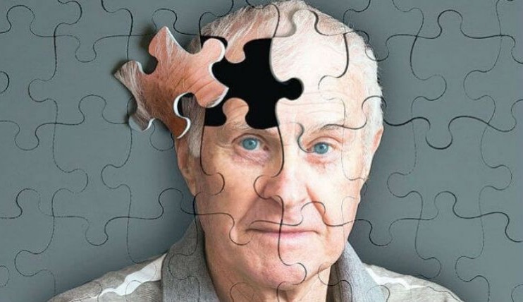 Entenda como mudar alguns hábitos no dia a dia pode prevenir o Alzheimer