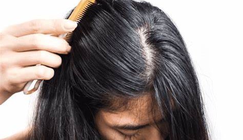 Saiba o que fazer para cuidar dos cabelos oleosos e melhorar a saúde dos fios