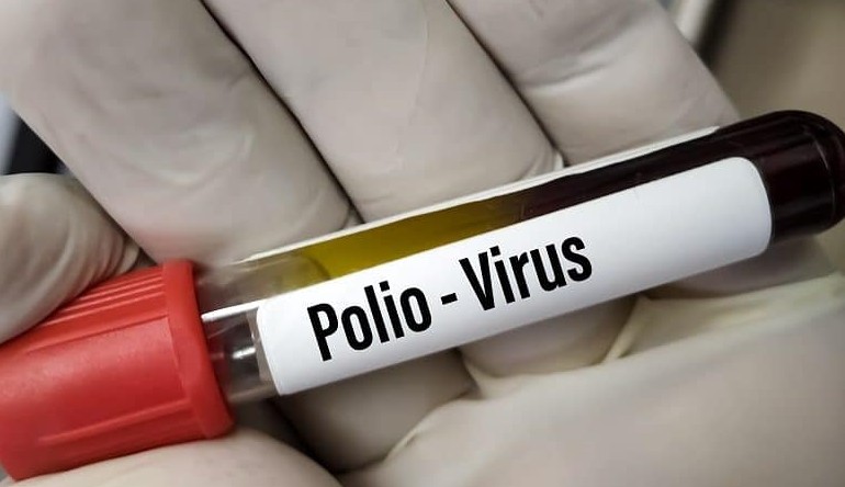 Foi confirmado primeiro caso de Poliomielite nos Estados Unidos