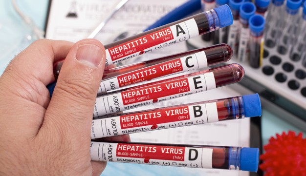 Aumenta no Brasil o número de pessoas infectadas com hepatite nos últimos 20 anos