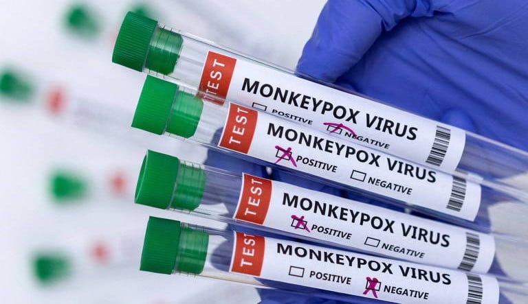 Brasil confirma três casos da Varíola dos macacos em crianças