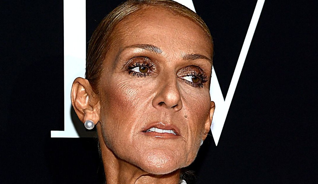 Celine Dion enfrenta a Síndrome da Pessoa Rígida e família oferece apoio