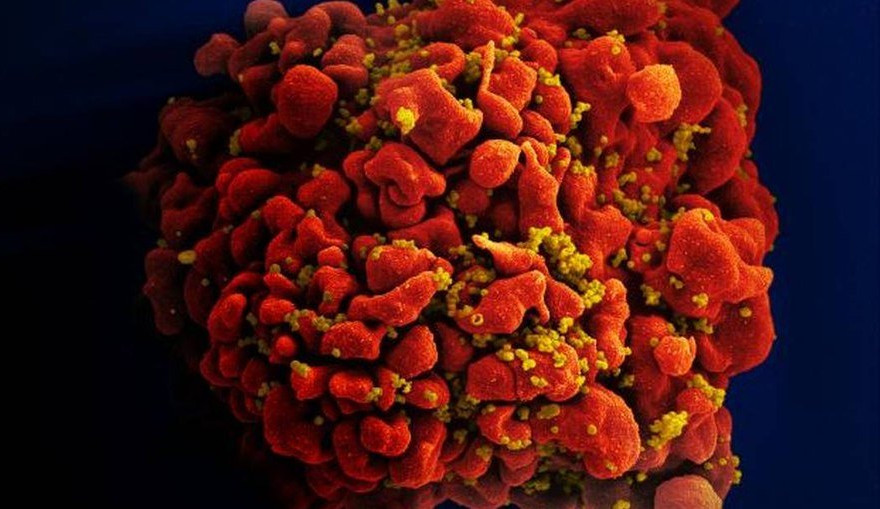Cura de paciente portadora do vírus HIV anima pesquisadores e pacientes 