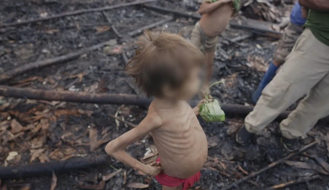 Tragédia Yanomami alcança 42 mortes em meio à emergência de saúde