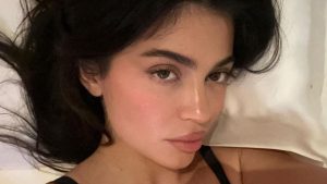 Botox: pacientes cada vez mais jovens buscam pelo tratamento antissinais