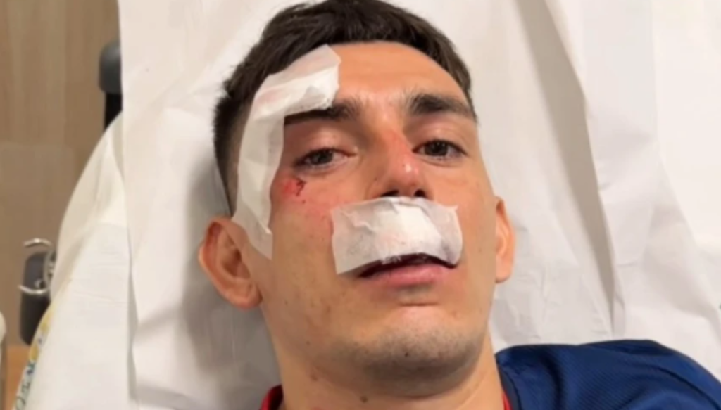 Ônibus do Fortaleza é atacado depois de jogo contra o Sport