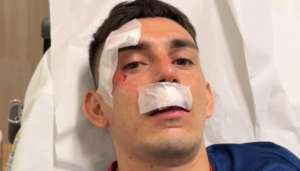 Ônibus do Fortaleza é atacado depois de jogo contra o Sport