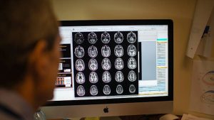 Crescimento do cérebro humano pode reduzir risco de demência, revela estudo