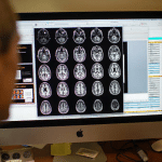 Radiografia de um cérebro