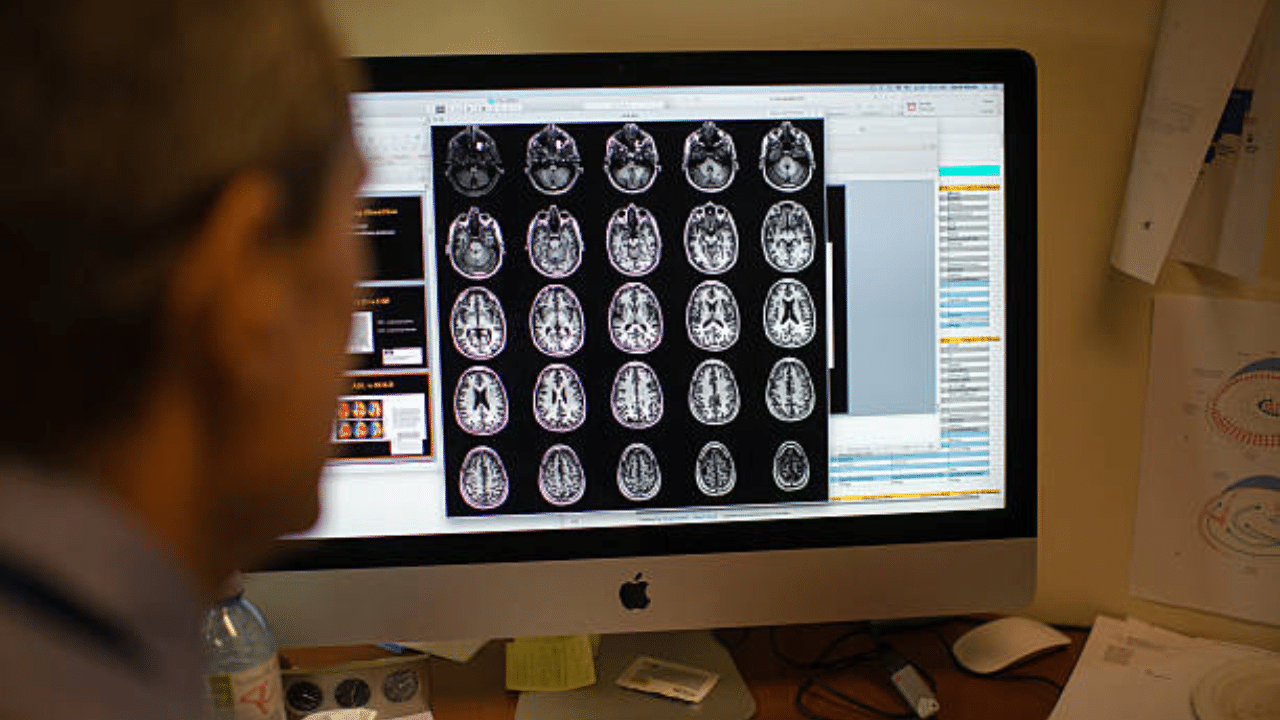 Radiografia de um cérebro