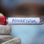 Um tubo com a identificação de monkeypox