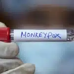 Um tubo com a identificação de monkeypox