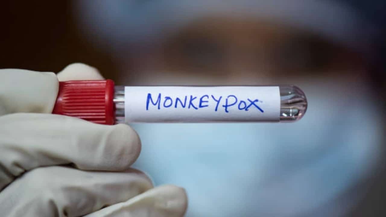 Um tubo com a identificação de monkeypox