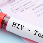 Testes de HIV falsificados