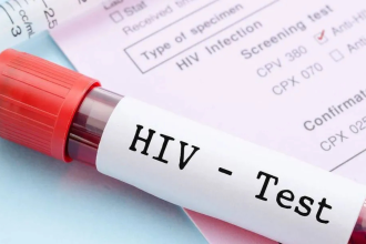 Testes de HIV falsificados