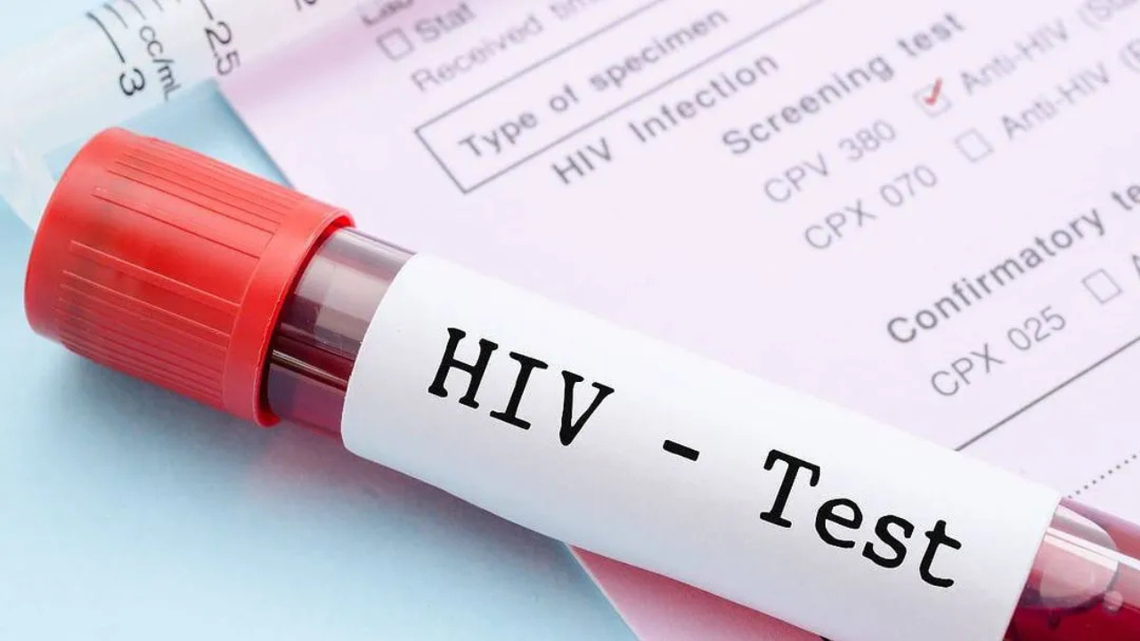 Testes de HIV falsificados