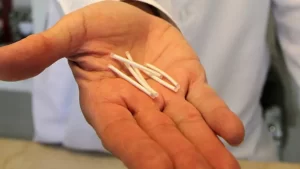 Anvisa suspende comercialização de implantes hormonais conhecidos como “chips da beleza”