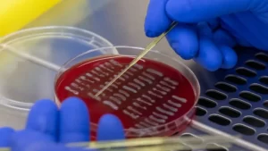 Saiba o que é E. coli, bactéria que causou surto de infecções nos EUA