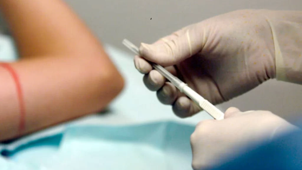 Farmácias vendem implantes hormonais como tratamento sem comprovação