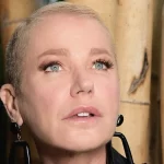 Entenda o que é Alopecia androgenética, doença que fez Xuxa querer raspar a cabeça