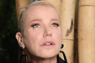 Entenda o que é Alopecia androgenética, doença que fez Xuxa querer raspar a cabeça