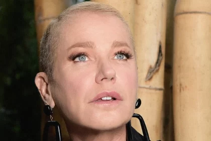 Entenda o que é Alopecia androgenética, doença que fez Xuxa querer raspar a cabeça