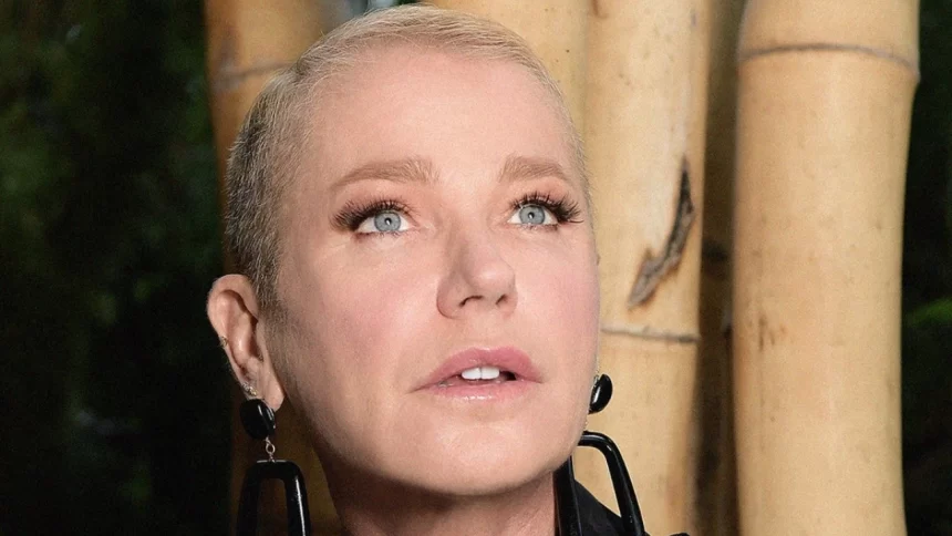 Entenda o que é Alopecia androgenética, doença que fez Xuxa querer raspar a cabeça