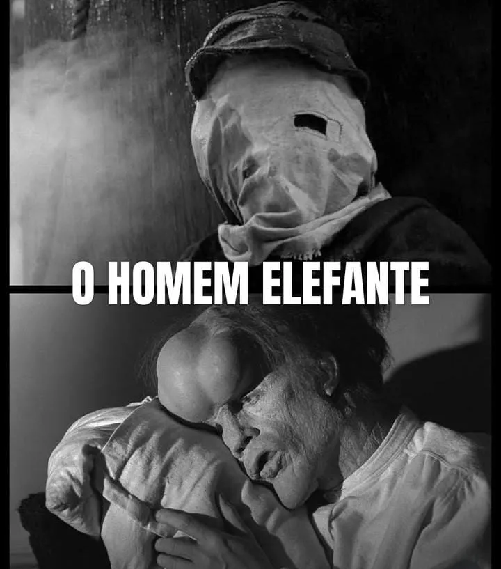 Filme " O homem elefante" 