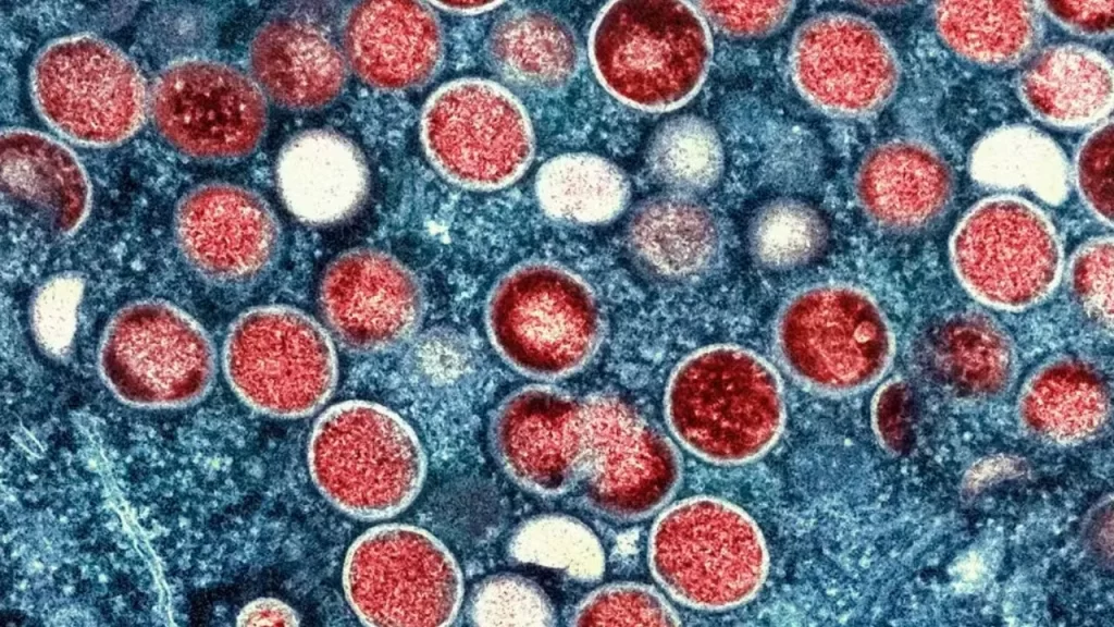 São Paulo registra primeiro caso de nova cepa de Mpox no Brasil