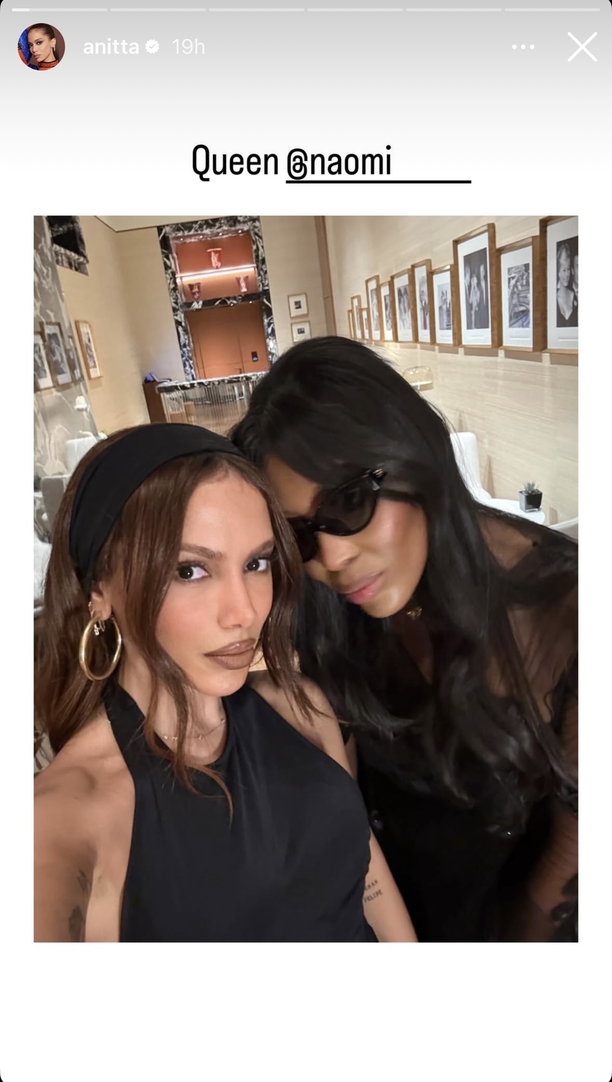 Anitta aparece com novo visual em Roma após procedimento estético e fotos com Sofía Vergara viralizam