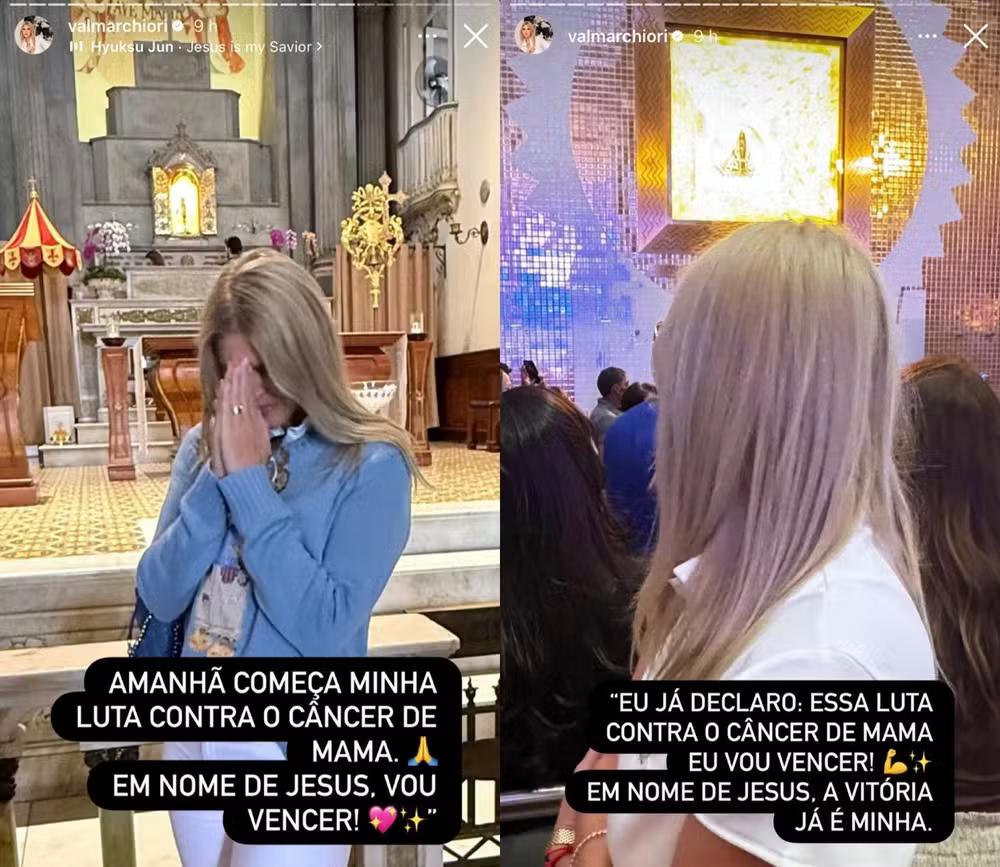 Val Marchiori inicia tratamento contra câncer de mama e compartilha mensagem otimismo