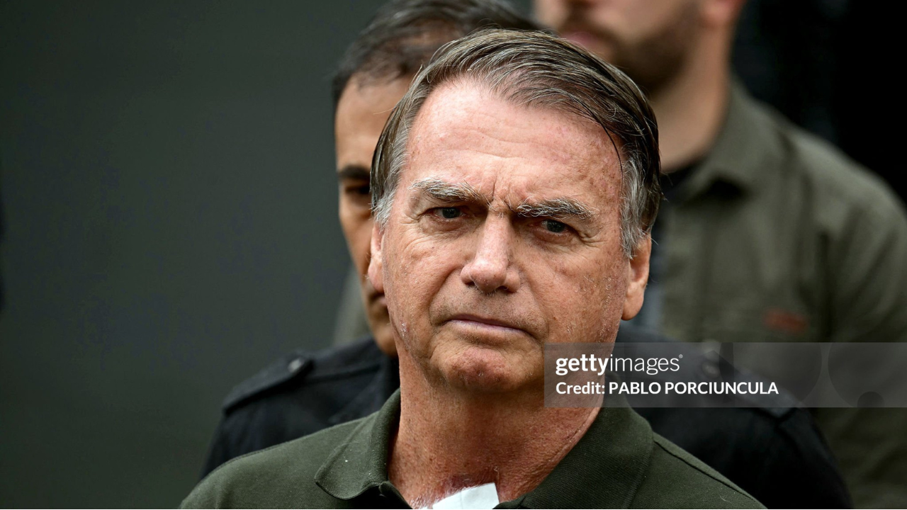 Bolsonaro faz pedido de visita médica após piora dos soluços