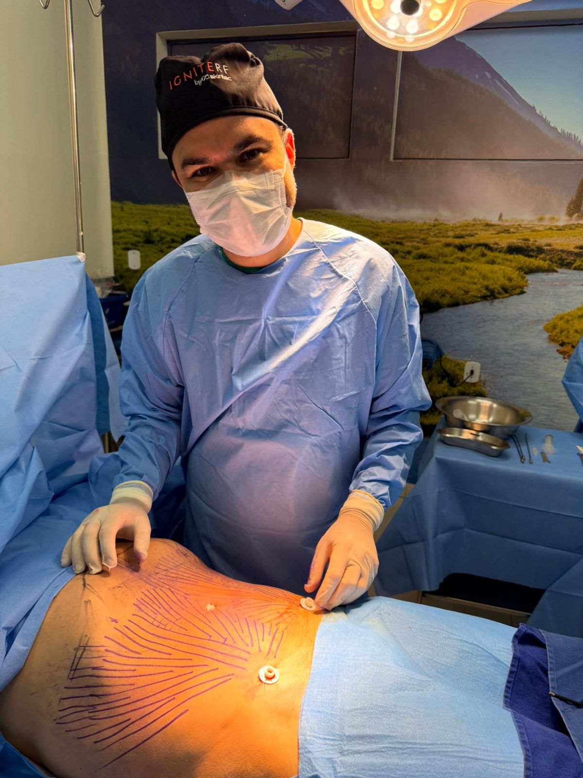 Dr. Cássio Vilhena explica como o Ignite RF eleva o padrão de acabamento em cirurgias plásticas Dr. Cássio Vilhena explica como o Ignite RF eleva o padrão de acabamento em cirurgias plásticas