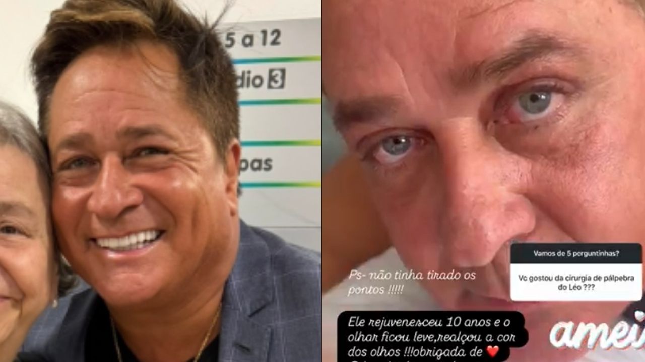 Leonardo passa por cirurgia estética e reacende debate sobre estética masculina Leonardo passa por cirurgia estética e reacende debate sobre estética masculina