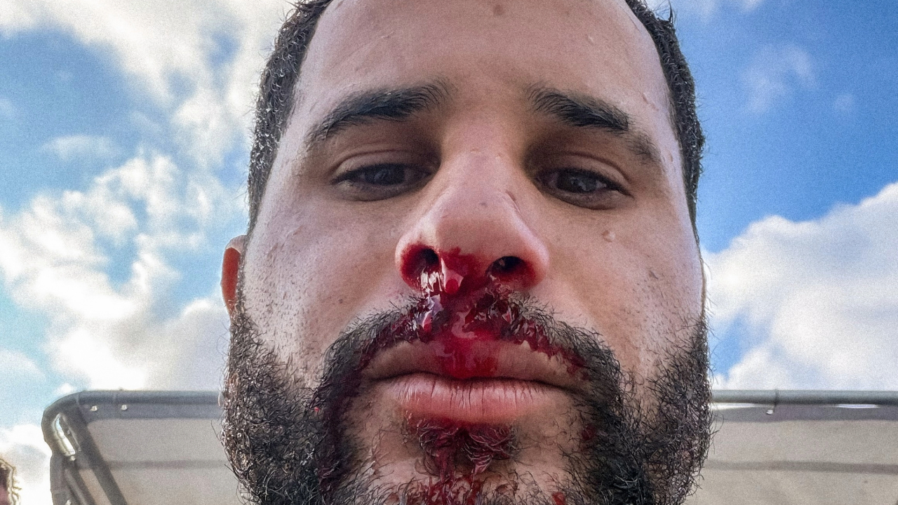 Italo Ferreira quebra o silêncio e compartilha detalhes do acidente sofrido no mar de Fiji; confira