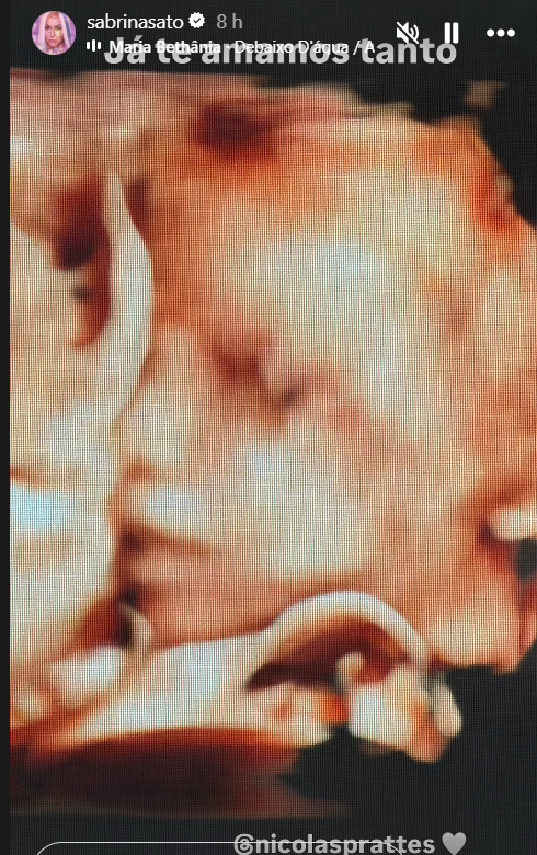 Sabrina Sato compartilha primeira imagem do rosto do bebê com Nicolas Prattes
