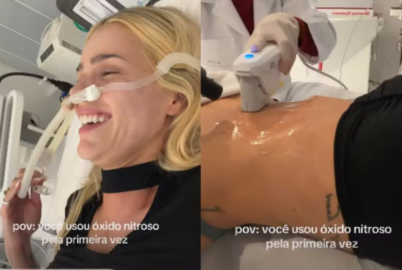 Yasmin Brunet passa por procedimento estético no abdômen e se diverte com gás do riso Yasmin Brunet passa por procedimento estético no abdômen e se diverte com gás do riso