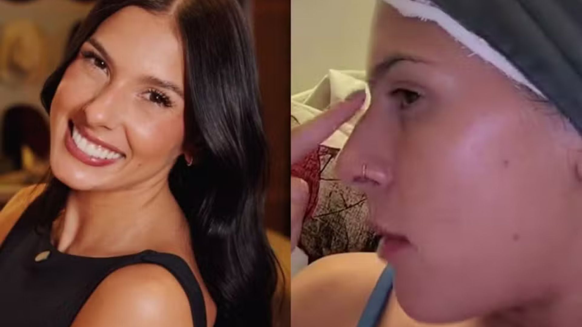 Ana Castela abre o jogo sobre procedimentos estéticos, rejeita silicone, mas planeja cirurgia no nariz: ‘Esse quebra-mola’
