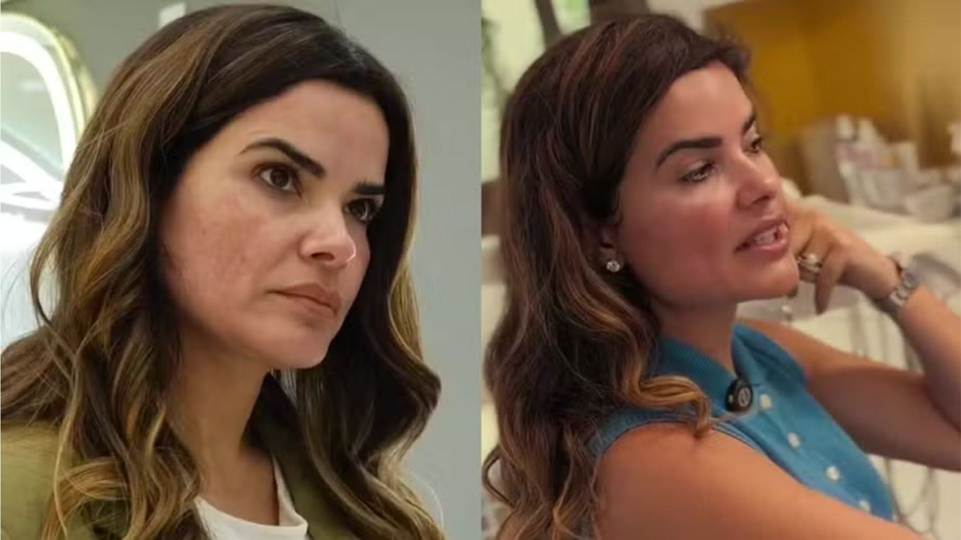 Vanessa Giacomo brinca com a autoestima lá no alto após cuidar da aparência do rosto