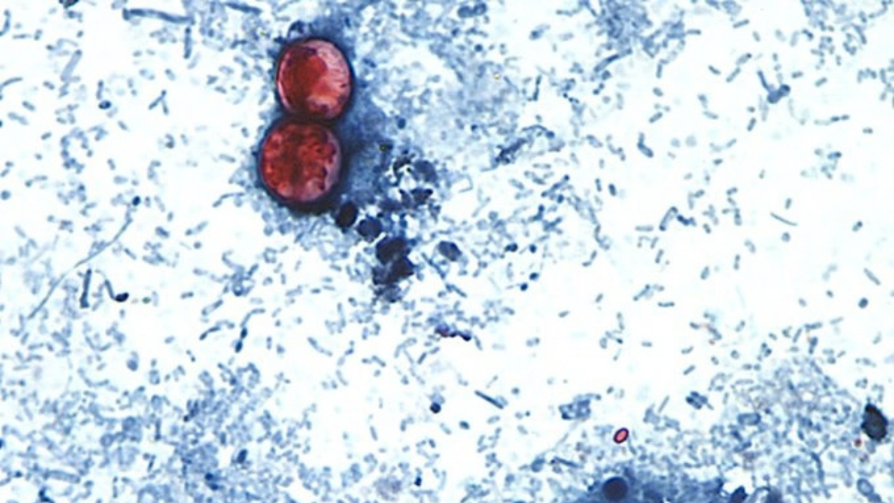 FDA detecta parasita ligado a surto de diarreia explosiva em fazenda de alface no México